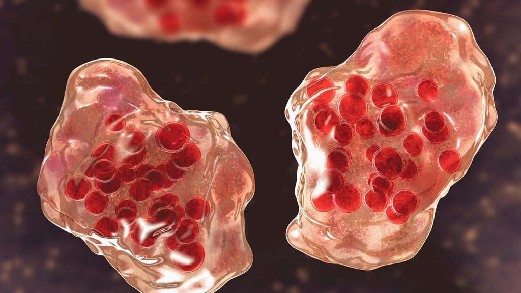 Central Minnesota county reports "several cases of suspected measles" — WCCO / CBS Minnesota, Chaska Health news