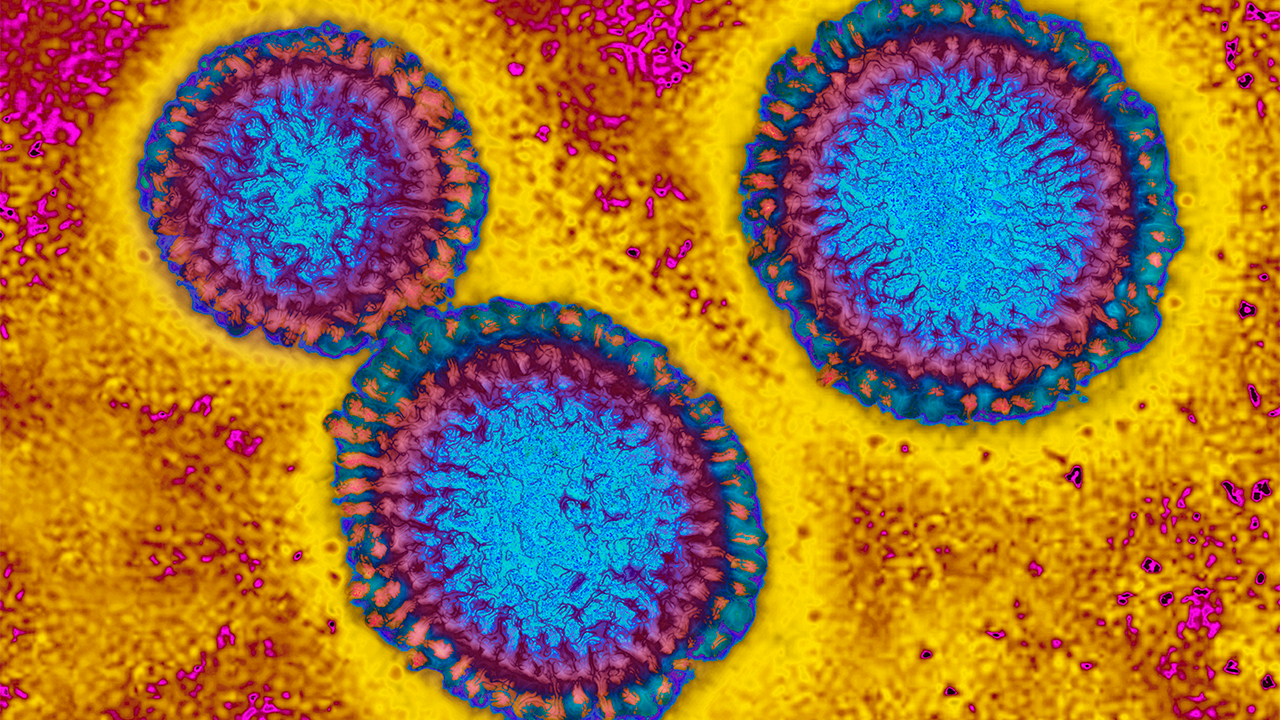 Flu hospitalizations 'slightly higher' than usual, officials urge vaccinations — FOX 9, Chaska Health news